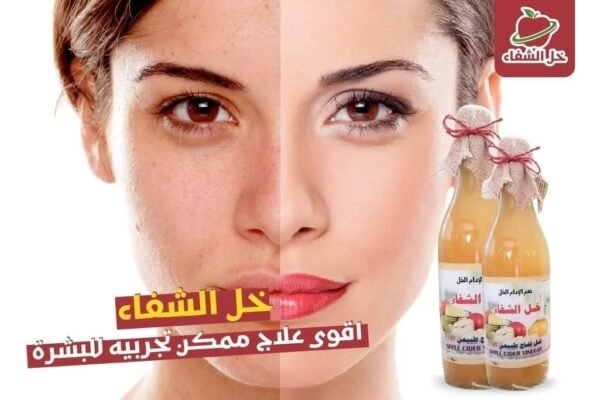 Apple Cider Vinegar ● 250 mL.
خل تفاح طبيعي الشفاء - Image 3